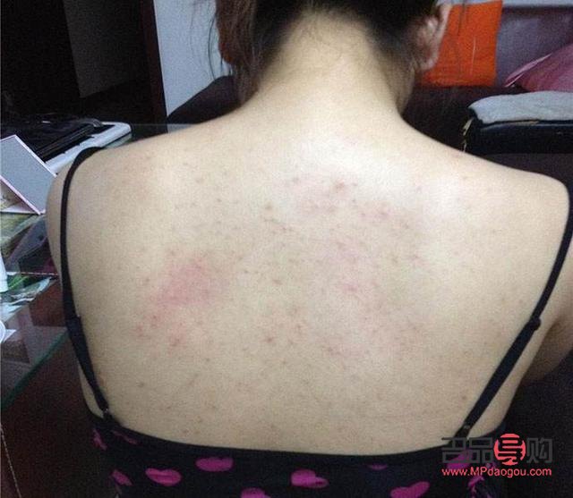 身体乳涂抹技巧与后背护理全攻略