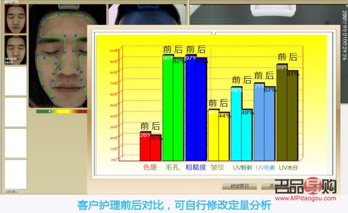 魔镜美容好吗(魔镜美容好吗安全吗)