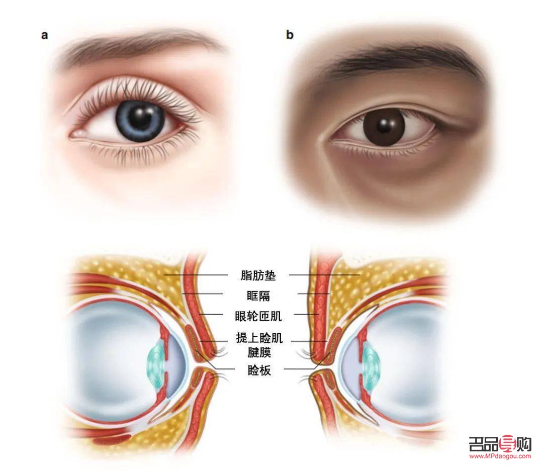 双眼皮种类图解大全：了解双眼皮的多样性与魅力