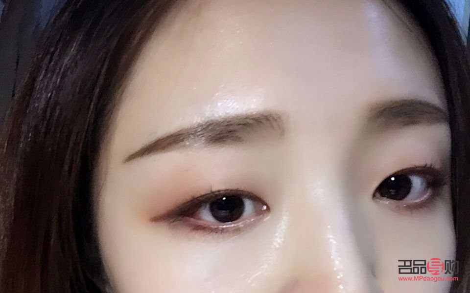 提拉眼皮术后多久恢复(提拉眼皮术后多久恢复自然)