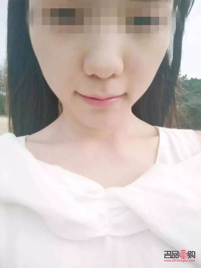 打脸能美容吗(打脸能美容吗女生)