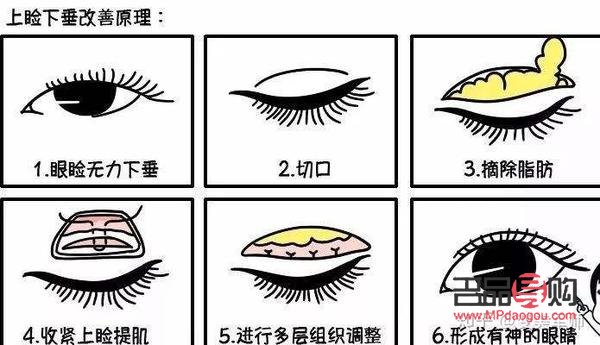 眼睑肌无力吃什么药(眼睑肌无力吃什么药最好)