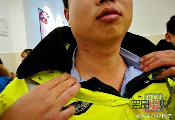 婴儿抓伤身体怎么护理(婴儿抓伤留下的印子好久能好)