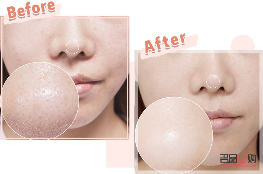 <h3>美容仪使用后,肌肤多久能吸收其效果?</h3> <h3>美容仪使用后,肌肤多久能吸收其效果?</h3>