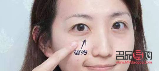 眼窝凹陷严重图片(眼窝凹陷严重图片儿童)