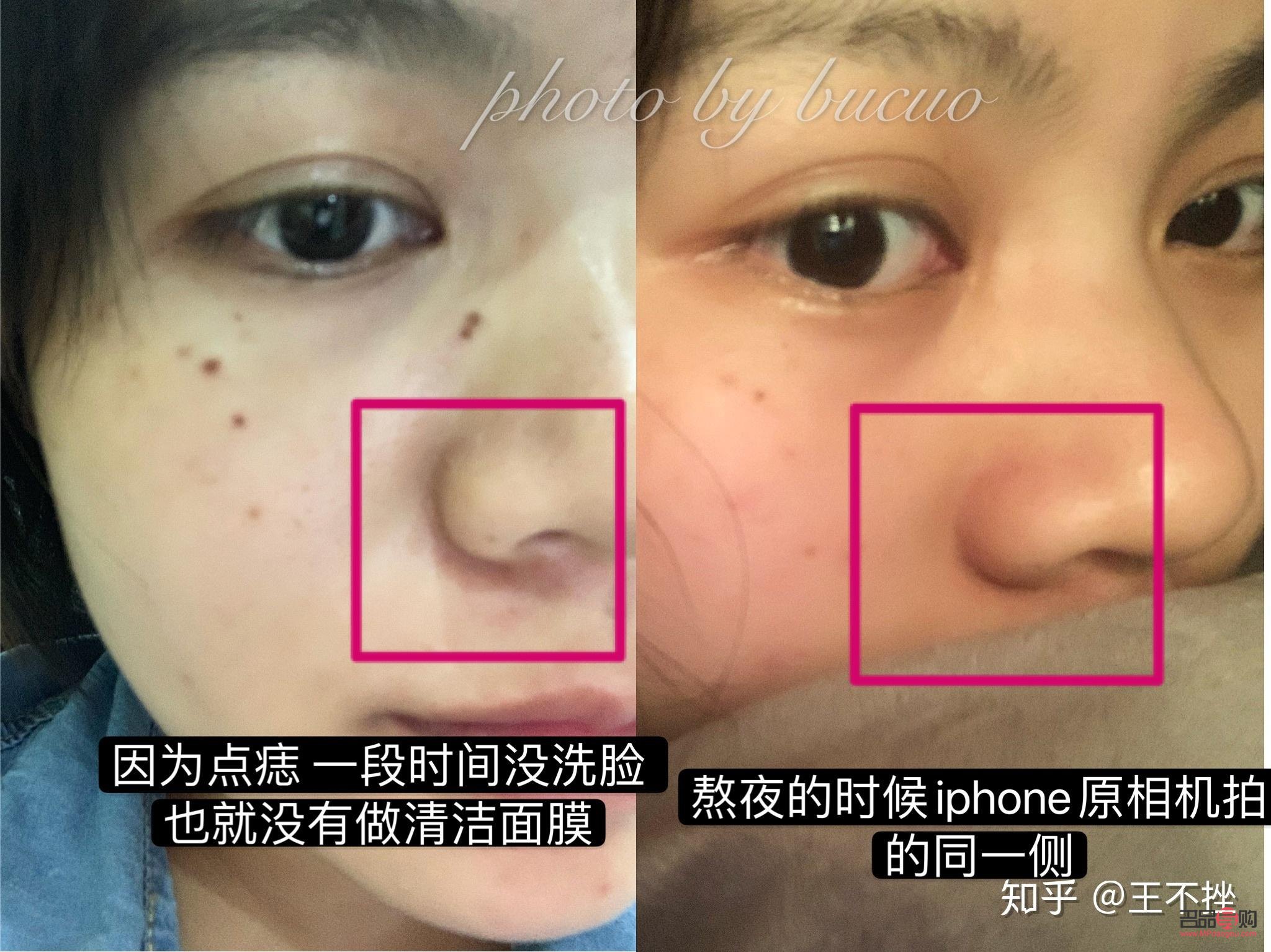 美容院点痣怎么点(美容院点痣怎么点的)