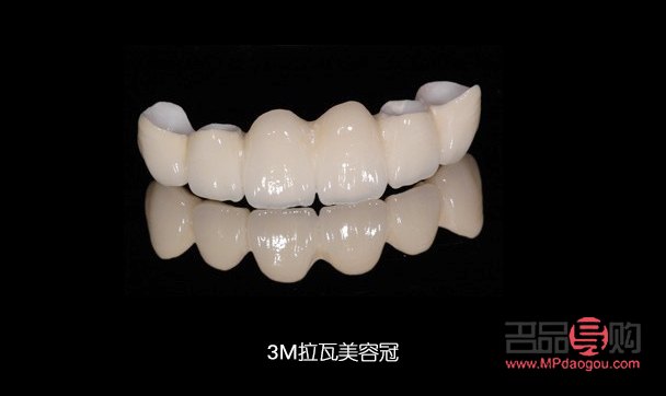 美容冠怎么样(美容冠怎么样好看)