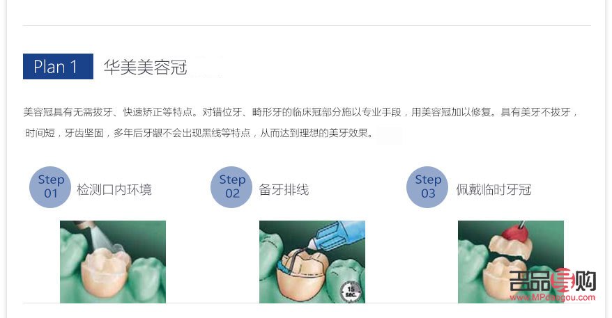 美容冠怎么样(美容冠怎么样好看)