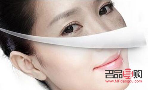 眼部超声刀怎么做(眼部超声刀做完什么时候见效果)