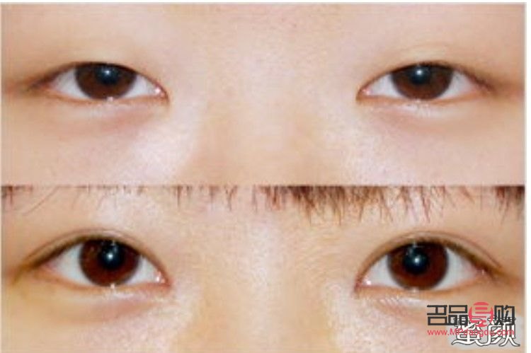<h3>从内双到外双：打造迷人双眼皮的秘诀</h3>