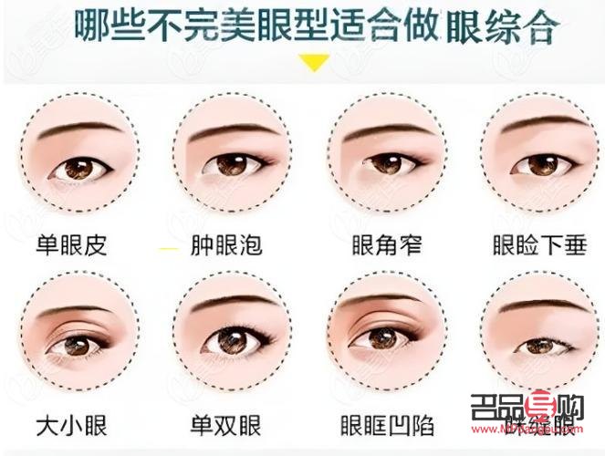 现在流行什么双眼皮技术(现在流行什么双眼皮技术呢)