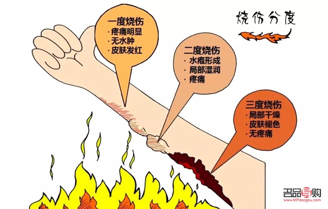 身体烫伤怎么护理好(身上烫伤)