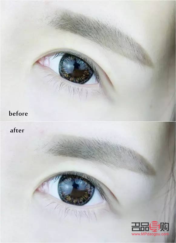 眼睛肿胀导致眼睛变小，如何应对？