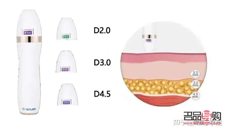 <h3>眼部超声炮：重塑青春明眸，价格与价值并存</h3>