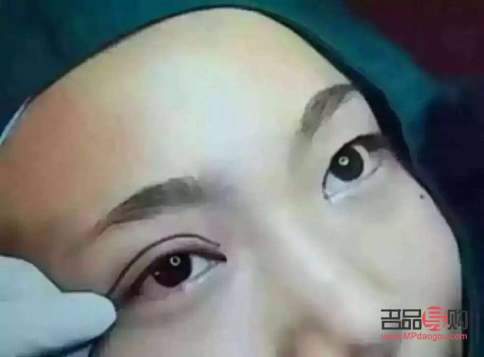 <h3>双眼皮定位解析：了解双眼皮美容手术的关键一步</h3>