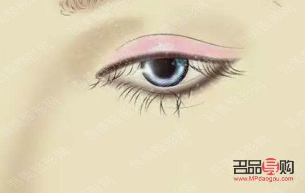 <h3>眼睑重建术：重塑眼部轮廓，重拾自信之美</h3>