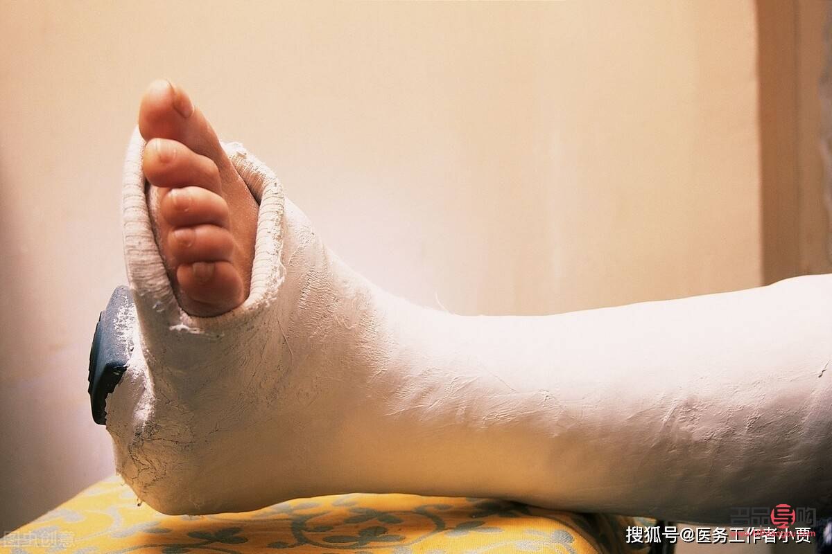 脚骨折能做身体护理吗(脚骨折能做身体护理吗视频)