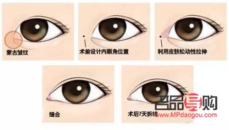 眼综合七项包括哪些(眼综合7项)