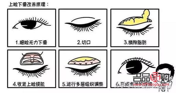 眼综合七项包括哪些(眼综合7项)