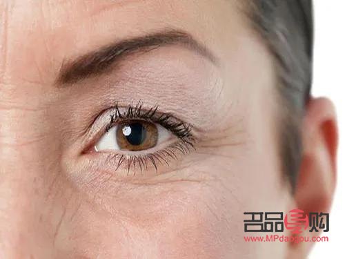 眼部干纹和细纹区别图(眼部干纹和细纹区别图片)