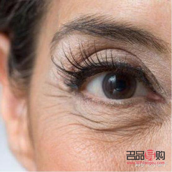 眼部干纹和细纹区别图(眼部干纹和细纹区别图片)