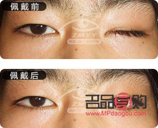 重庆义眼定做有哪些(重庆义眼定做有哪些地方)