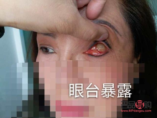 重庆义眼定做有哪些(重庆义眼定做有哪些地方)