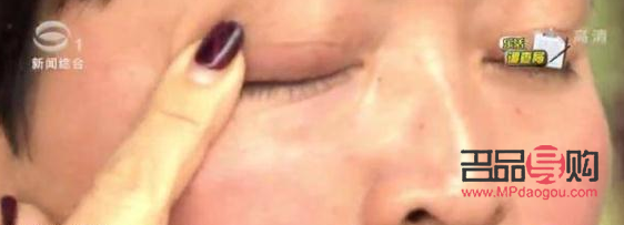 <h3>天生大小眼问题解析：女生是否能进行矫正？</h3>