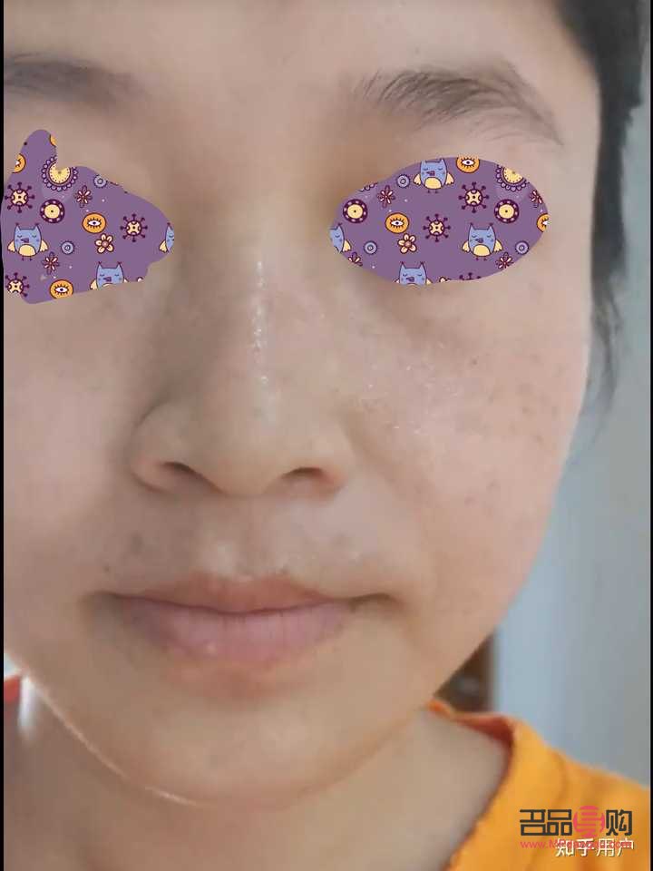 <h3>美容院祛雀斑效果好吗？专业分析与建议</h3>