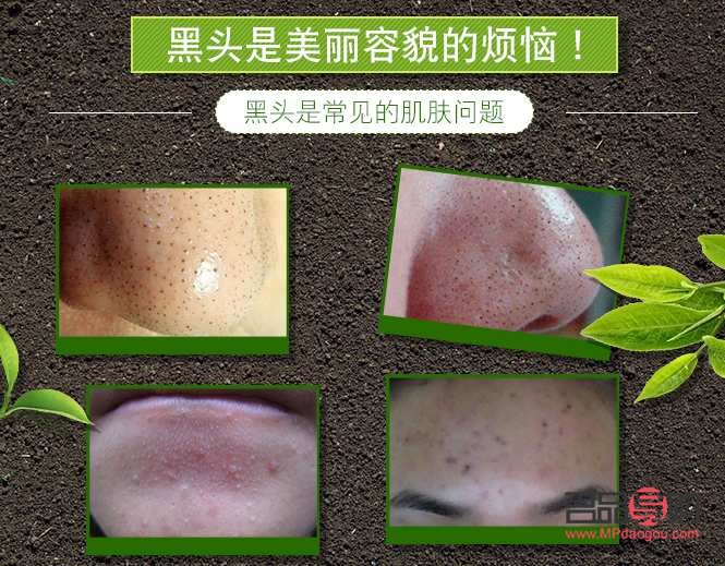 <h1>美容秘诀：如何高效去除黑头</h1>