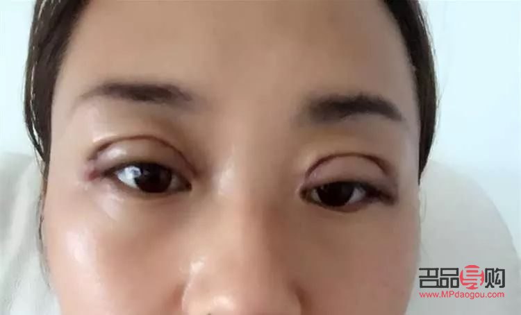 最适合做双眼皮的眼睛(最适合做双眼皮的眼睛图片) 最适合做双眼皮的眼睛(最适合做双眼皮的眼睛图片)