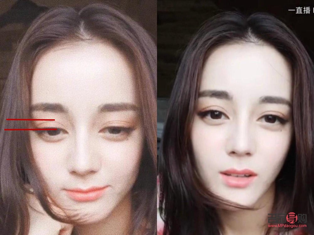 明星双眼皮前后对照图图片(明星双眼皮前后对照图图片女)