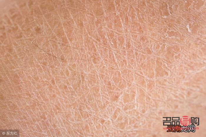 身体干燥怎么护理最好(身体干燥怎么护理最好呢)