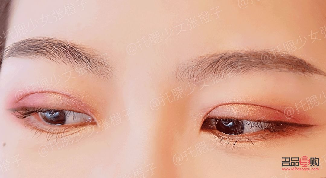 双眼皮手术价格种类全解析