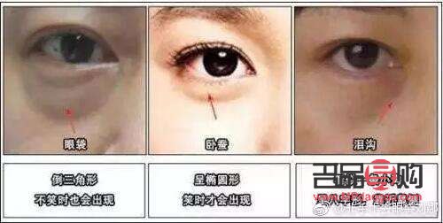 <h3>眼袋切除后是否还会再次生长？</h3>