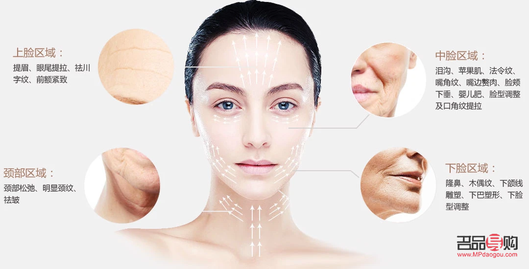 什么是美容提拉线(什么是美容提拉线的作用)