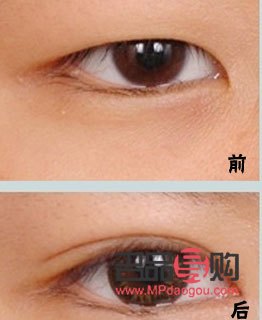 哪种双眼皮最好看最安全可靠的(哪种双眼皮最好看最安全可靠的方法)