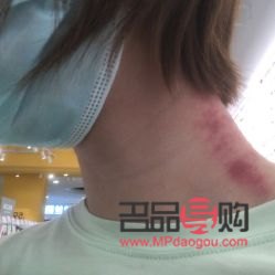 盛爱美容怎么样(盛爱美容怎么样可靠吗)