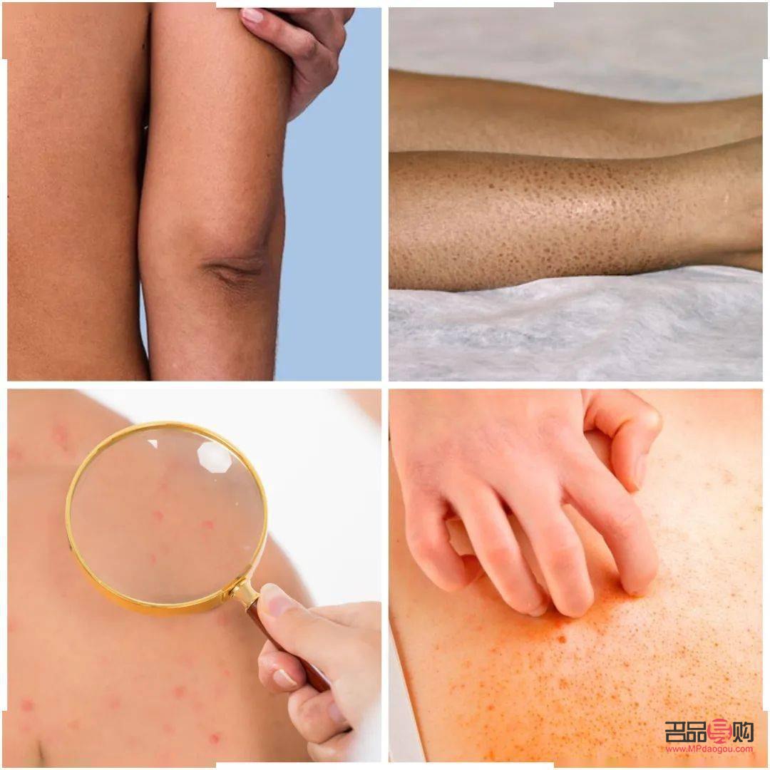 做身体护理做哪些(做身体护理做哪些部位)