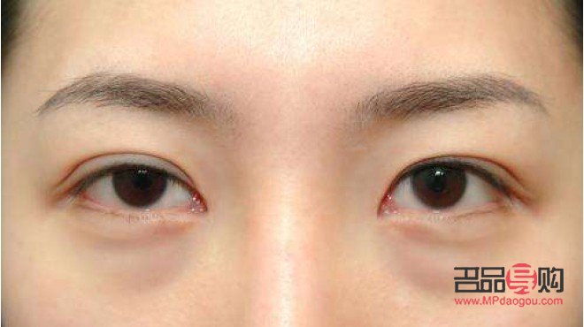 <h1>掌握秘诀，跟黑眼圈眼袋说再见！</h1>