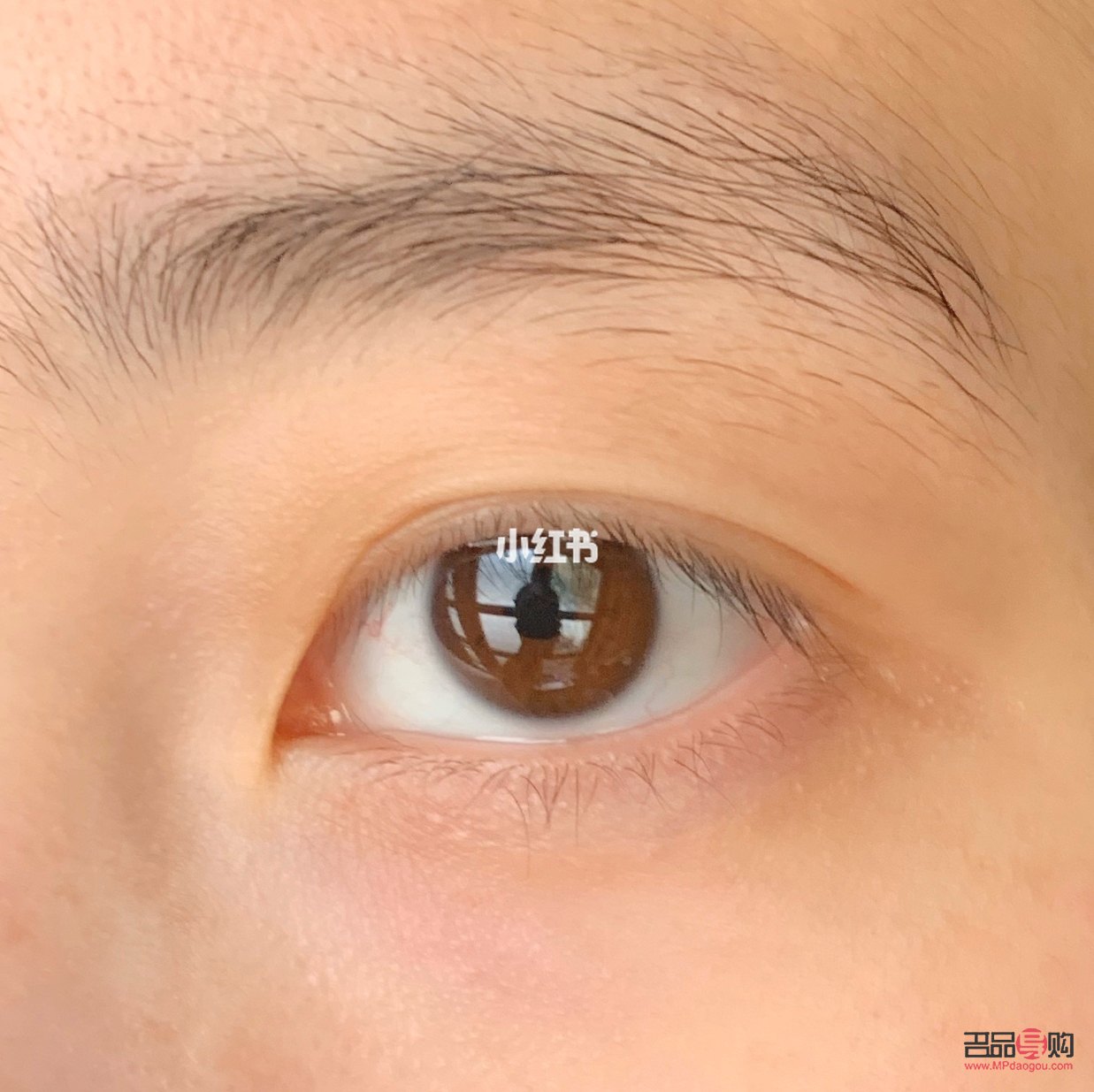 三眼皮怎么变回双眼皮(三眼皮怎么变回双眼皮学生) 三眼皮怎么变回双眼皮(三眼皮怎么变回双眼皮学生)