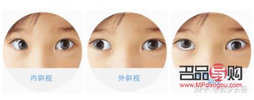 眼球偏移可以矫正吗(眼球偏移可以矫正吗多少钱)