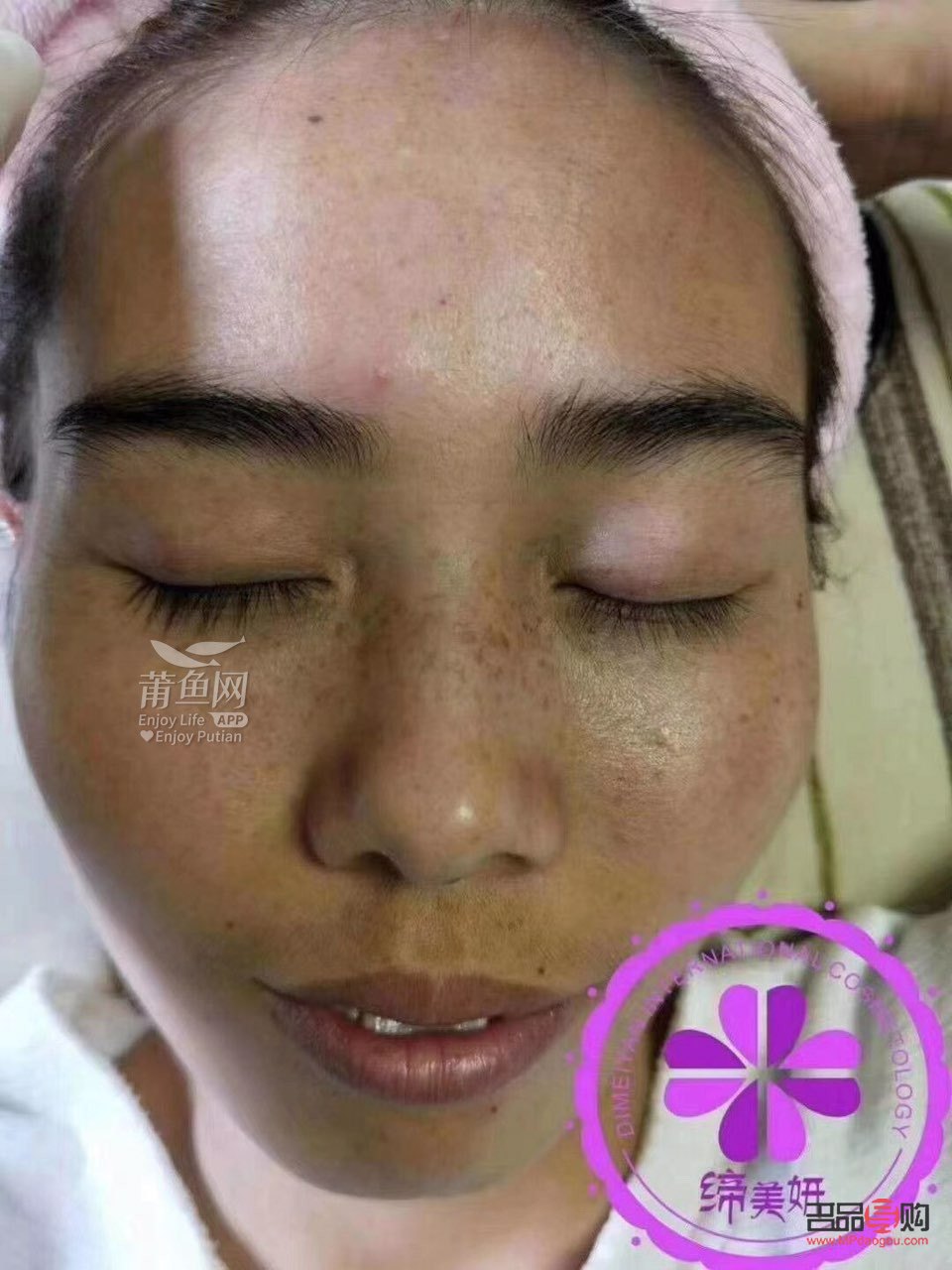 <h3>寻找最佳祛斑美容圣地</h3>