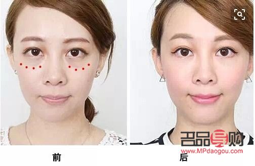 鑫汇美容祛眼袋地址(鑫汇美容祛眼袋地址在哪里)