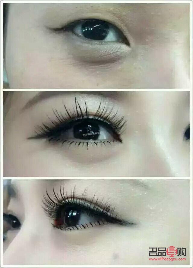 <h3>单眼皮学生如何自然变双眼皮</h3>