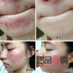 豆豆身体护理怎么做(豆豆身体护理怎么做视频)