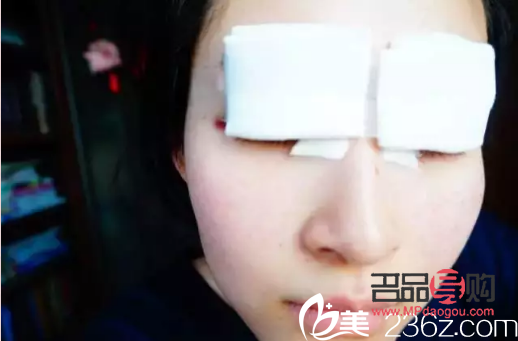 开扇双眼皮怎么做视频(开扇双眼皮怎么做视频教程)