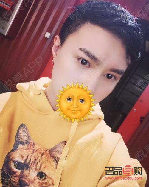 半切双眼皮和全切双眼皮哪个好(半切双眼皮和全切双眼皮哪个好一点)