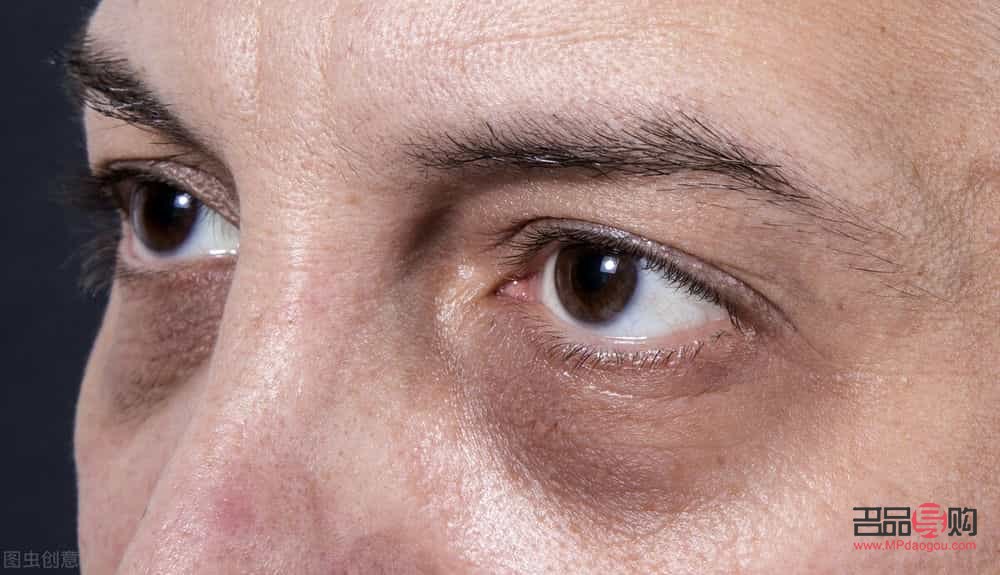 眼袋黑眼圈好重怎么办(眼袋黑眼圈好重怎么办图片) 眼袋黑眼圈好重怎么办(眼袋黑眼圈好重怎么办图片)