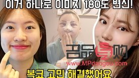 探索女性双眼皮之美：哪款双眼皮最受欢迎？